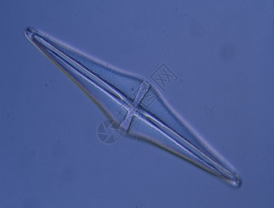 100x 显微镜下的海洋对流器宏观绿色藻类浮游生物海藻黑色植物圆形硅藻背景图片
