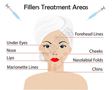 妇女面对皮肤填充器肉毒杆菌注射治疗区插图商业塑料卫生美学皱纹诊所脸颊病人线条插画