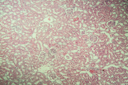 显微镜下的肾脏皮层 100x皮质康复老兵肾小球组织学组织宏观胶囊药品诊断背景图片
