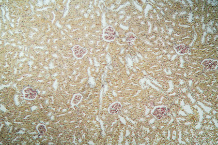 显微镜下的肾脏皮层 100x诊断肾小球单位组织学专用医药组织考试康复药品背景图片