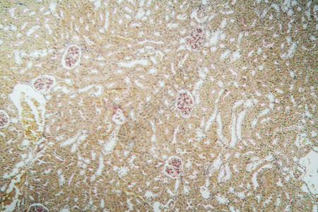 显微镜下的肾脏皮层 100x皮质单位诊断组织宏观医药胶囊肾小球组织学药品背景图片