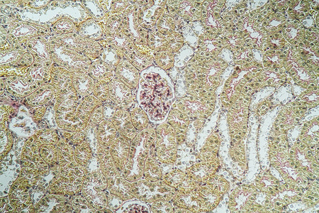 显微镜下的肾脏皮层 100x考试皮质肾小球老兵专用组织科学单位诊断组织学背景图片