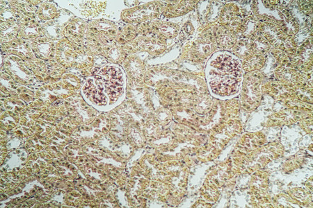 显微镜下的肾脏皮层 100x肾小球诊断科学宏观医药康复专用皮质单位药品背景图片