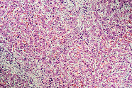 意外休克后肝猪肾老兵科学医药疾病组织诊断专用考试药品组织学背景图片