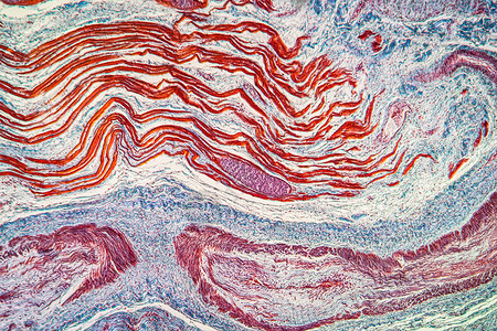 肌肉中附虫鳍寄生虫 100x科学蓝色疾病组织放大镜幼虫病理宏观细胞背景图片