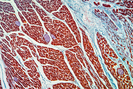 肌肉中附虫鳍寄生虫 100x细胞蓝色幼虫组织宏观放大镜病理科学疾病背景图片
