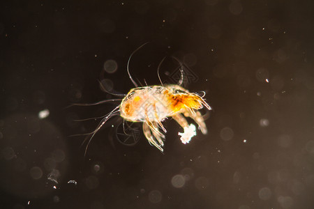 塞豪斯显微镜下的房屋灰尘泥宏观暗场过敏害虫口器螨虫疾病寄生虫科学背景