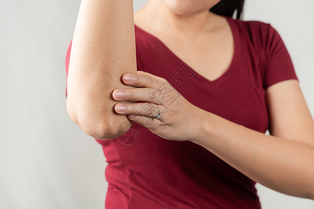 手肘疼女孩手肘疼痛 年轻妇女受伤 医疗保健和医疗概念手臂压力药品手指治疗按摩背痛肌肉皮肤女性背景