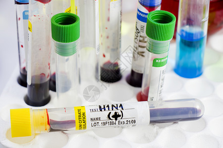 H1N1猪流感 诊断和化验 血液测试管样本 文本和信件唱歌危险肺炎实验室治疗发烧技术液体预防药品背景图片