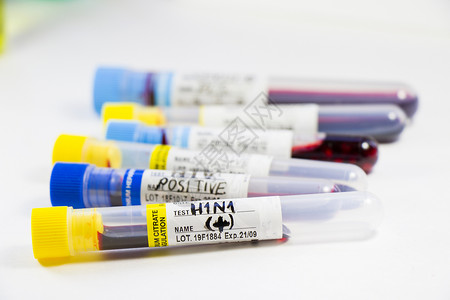 H1N1猪流感 诊断和化验 血液测试管样本 文本和信件预防疾病技术液体血液学治疗感染实验室病人唱歌背景图片