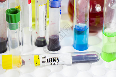 H1N1猪流感 诊断和化验 血液测试管样本 文本和信件化学品细菌感染感染疾病发烧病人唱歌危险实验室流感背景图片