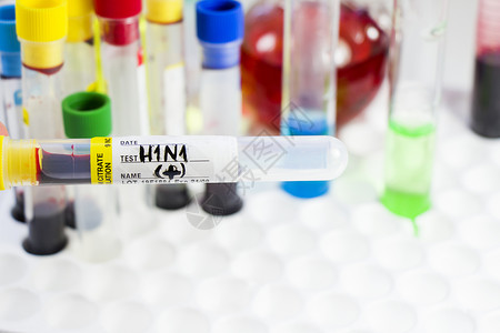 H1N1猪流感 诊断和化验 血液测试管样本 文本和信件细菌感染预防疾病唱歌血液学危险治疗疫苗技术肺炎背景图片