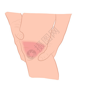 腿矢量图解的天冬骨膝盖关节问题骨折骨科骨头跑步玩家症状肿胀创伤男人治疗图片