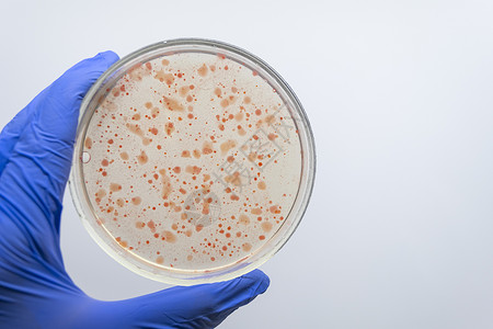 科学家手握着一种含有红色细菌的Petri盘子高清图片