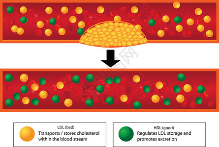 低密度脂蛋白鲜血容器中好的和坏的脂质的作用以及无神水力标志板的水平插画