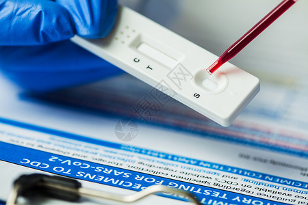 血标本医学实验室技术人员使用吸管将血样标本放在快速诊断测试上背景