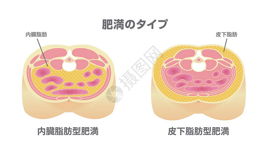 上皮下日本的肥胖插图类型 腹部剖视图 内脏脂肪 皮下脂肪横截面饮食损失卫生数字男性代谢保健疾病重量插画