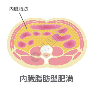 脂肪代谢日本的肥胖插图类型 腹部剖视图内脏 fa脂肪卫生生物学药品身体科学器官代谢损失疾病插画