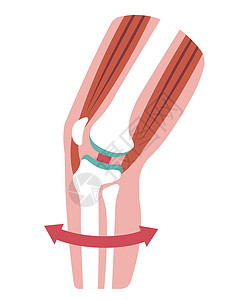 腿受伤膝关节剖面图替代品插图骨关节炎生物骨科药品女士骨骼治疗疾病插画