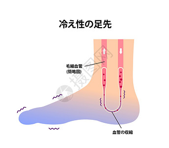 脚冷冷脚血液循环插图对寒冷脚趾日本人的敏感性卡通片寒冷成人女性器官蓝色寒潮流感女士疾病插画