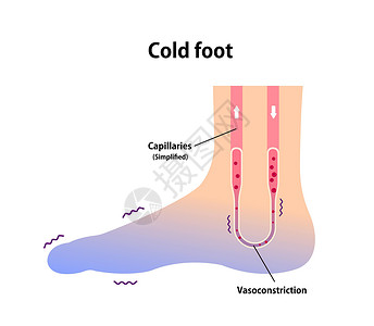 护脚霜冷脚血液循环图示对冷脚趾的敏感性流感状况女士卡通片女性身体疼痛症状疾病温度插画