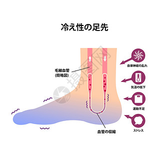 脚冷冷脚血液循环插图对寒冷脚趾日本人的敏感性成人流感卡通片寒冷脚趾状况身体器官女士疼痛设计图片