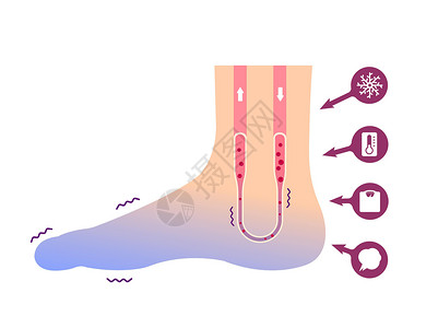 护脚霜冷脚血液循环插图对寒冷脚趾的敏感性 No tex状况卡通片器官蓝色疾病流感女性温度症状寒潮插画