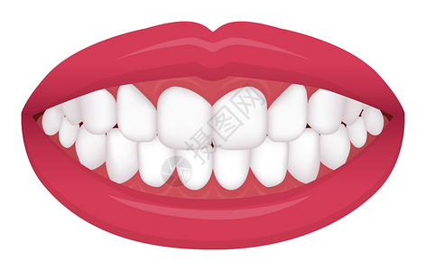 嘴型逗牙齿问题咬合型歪牙矢量图甚至牙齿 正常牙齿插画