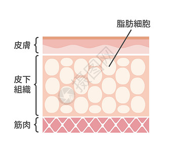 插管它制作图案的脂肪细胞剖面图健康治疗病人医生重量插图女性解剖学组织医师插画