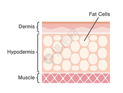 吸气吐气它制作图案的脂肪细胞剖面图程序药品饮食治疗女性损失插管化妆品橘皮吸气插画