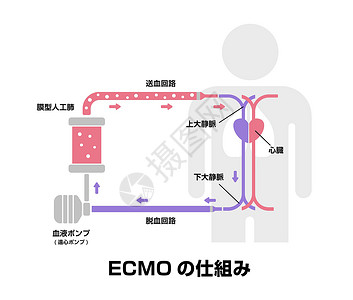 血氧仪ECMO体外膜氧合结构矢量图日本插画