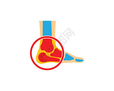 足跟痛脚骨骨标志矢量图制作图案前脚插图医师科学身体药品远端舟状骨科近端插画