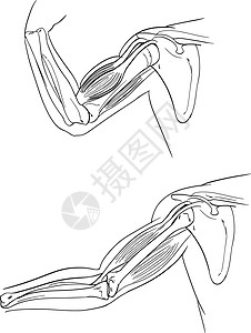 右内侧直肌人性化插画