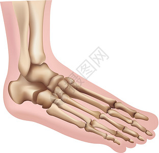 足跟痛脚注脚生物学距骨跖疣楔形骨骼风湿腓骨跟骨老茧男人插画