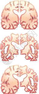大脑额叶人脑中枢神经障碍科学额叶脑脊液哺乳动物健忘症系统过敏反应男人插画