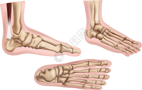 足跟骨刺脚骨插画