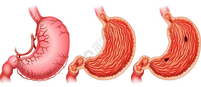 胃解剖学科学横幅木板医疗疾病神经红色卡通片学习背景图片