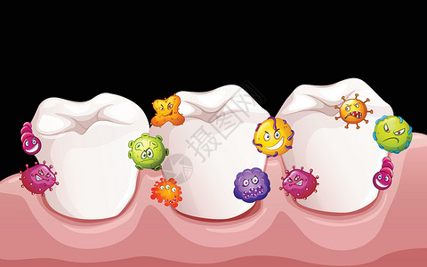 人类牙齿中的细菌插画