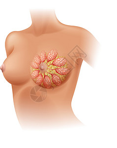 胸部特写详细的乳腺癌图医疗身体插图疾病药品白色夹子科学解剖学人体插画