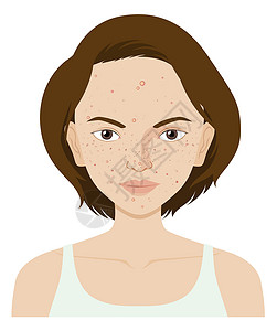 女性肌肤雀斑缺水问题困扰面部皮肤有问题的女人小路疾病剪裁女性皮疹医疗疙瘩绘画艺术女士插画