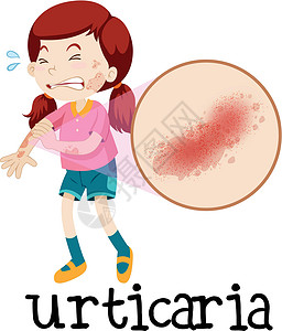 吞噬作用白色背景上有荨麻疹的女孩插画