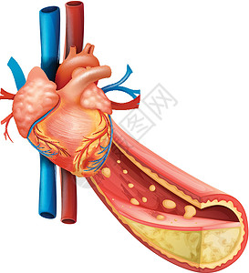 心脏静脉显示人的心脏和脂肪静脉的图插画