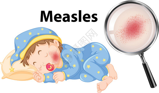 婴儿面部麻疹的载体背景图片