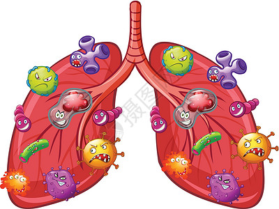 排放量肺部细菌的载体插画