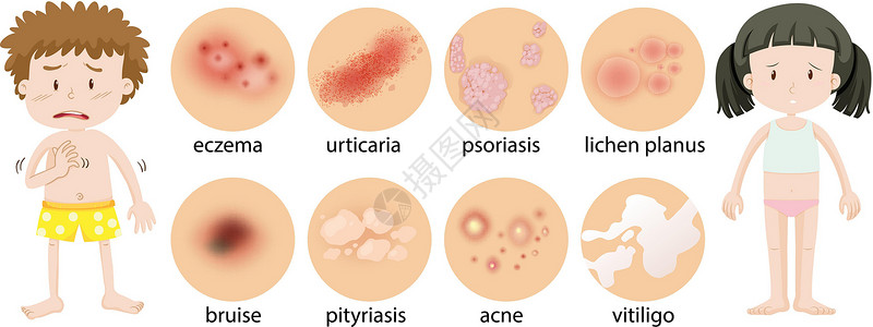 孩子皮肤不同皮肤状况的幼儿插画