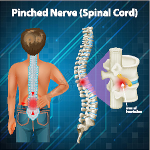 脊髓损伤显示脊髓的图教育学习女孩生物学插图卡通片脊柱海报解剖学药品设计图片