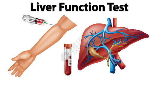 流血教育用肝功能检测套装设计图片