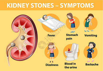 肾结石症状卡通风格 infographi病人艺术框架弱点教育疼痛药品呕吐绘画肚子图片