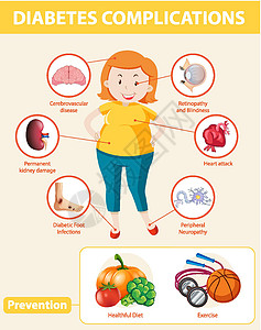 保健食用油脂糖尿病并发症和预防的医学信息图症状健身房器官海报生物学插图科学神经感染生理设计图片