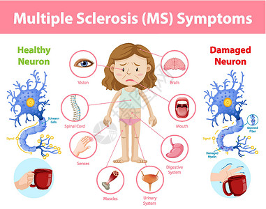 多发性骨髓瘤多发性硬化症 MS 症状信息 infographi弱点框架病人疼痛指示牌绘画身体插图解剖学学习插画